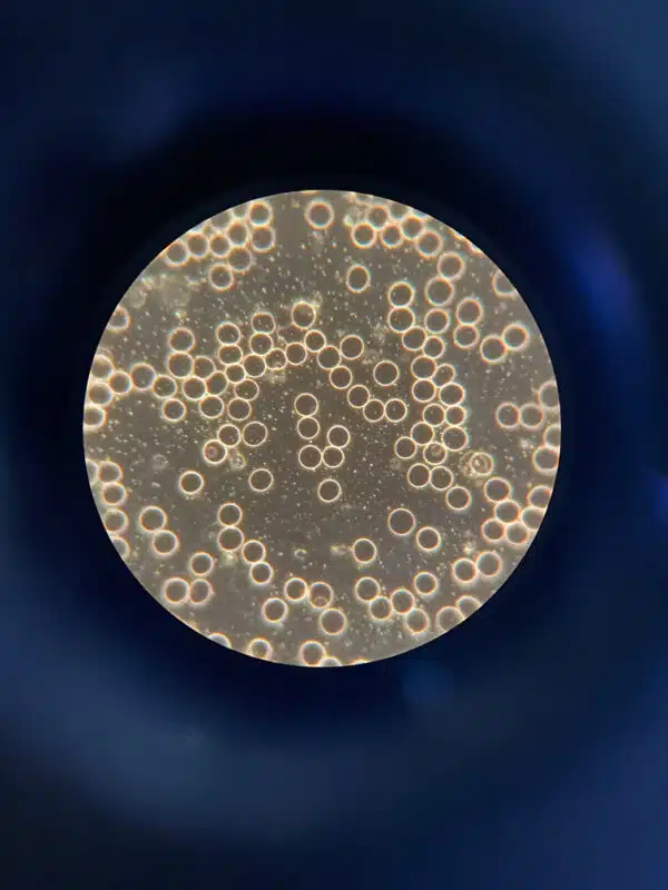 Das Blut nach dem Rotwein Konsum.