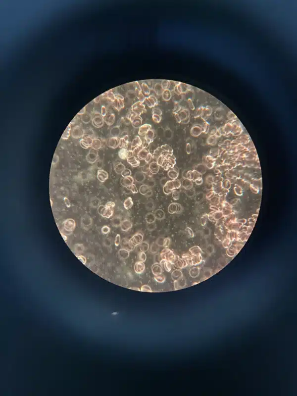 Das Blut vor dem Rotwein Konsum.